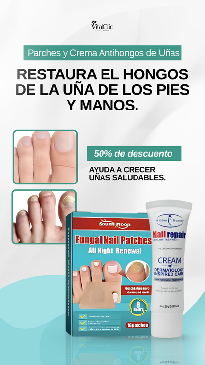 Kit de Parches y Crema Antihongos de Uñas - 😱50% DE DESCUENTO😱