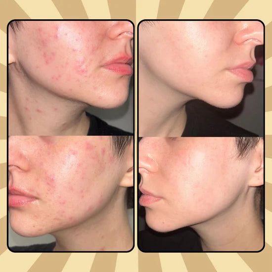 Facial Tallow® - Crema de Sebo de Res y Miel 😱PRODUCTO EN TENDENCIA😱